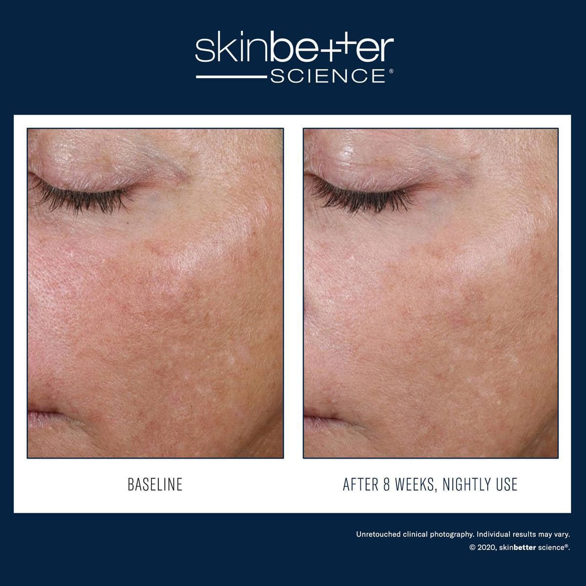 Skinbetter Science - AlphaRet Overnight Cream