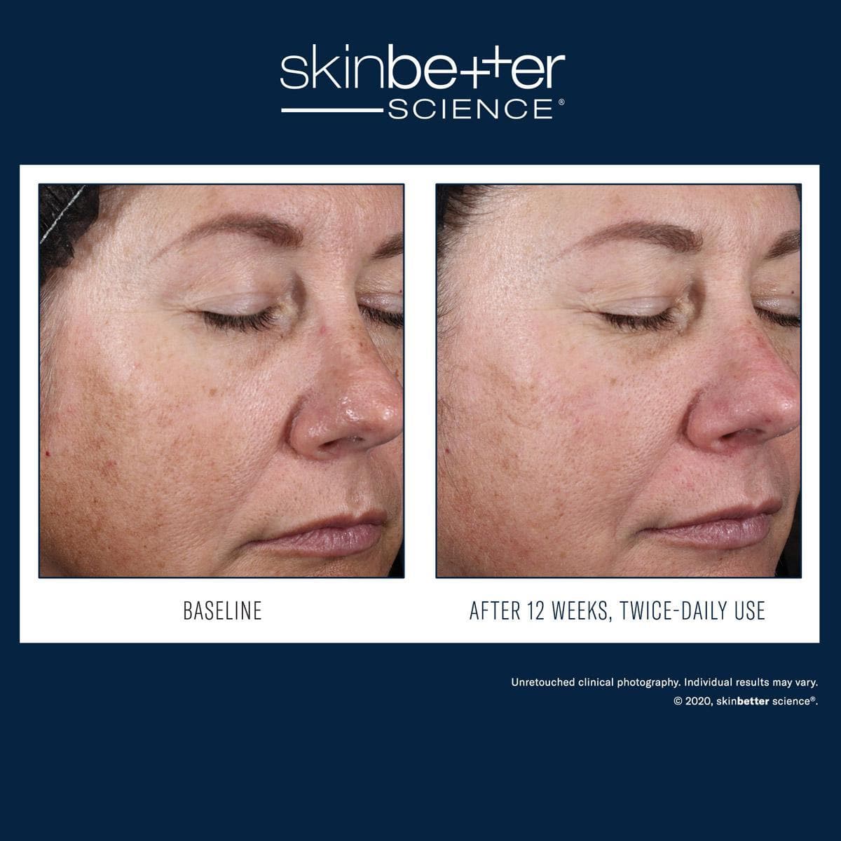 Skinbetter Science - Alto Advanced Defense and Repair