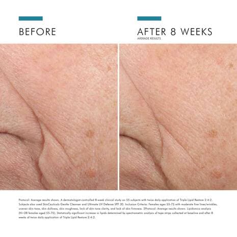 SkinCeuticals Triple Lipid Restore