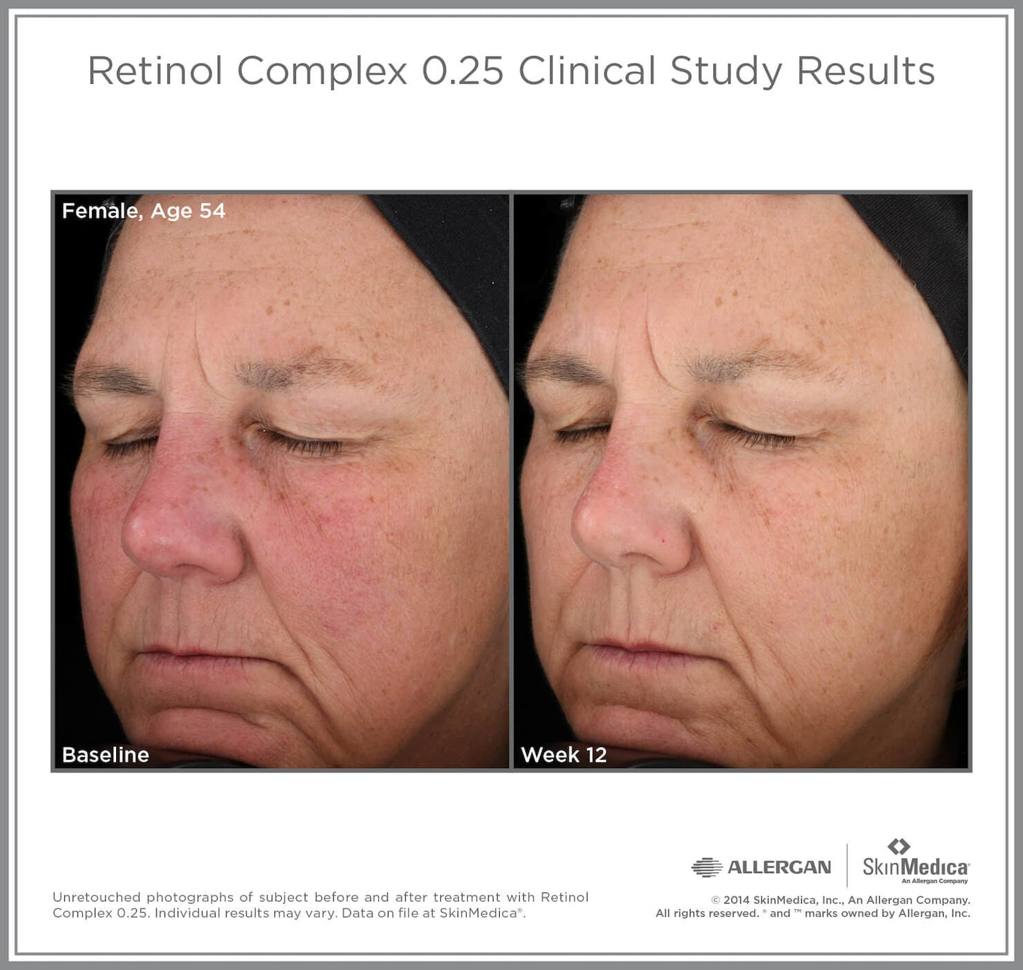 SkinMedica Retinol Complex