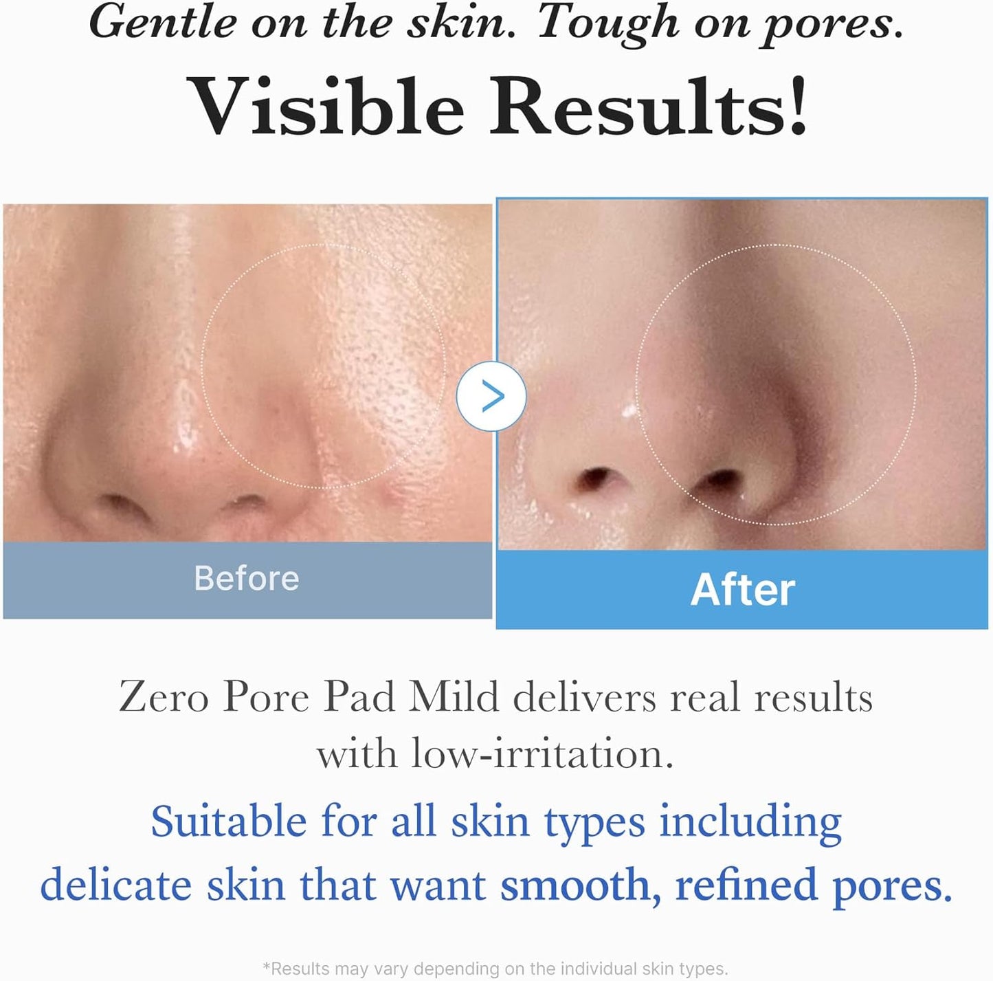 medicube Zero Pore Mild Pad 70 pads