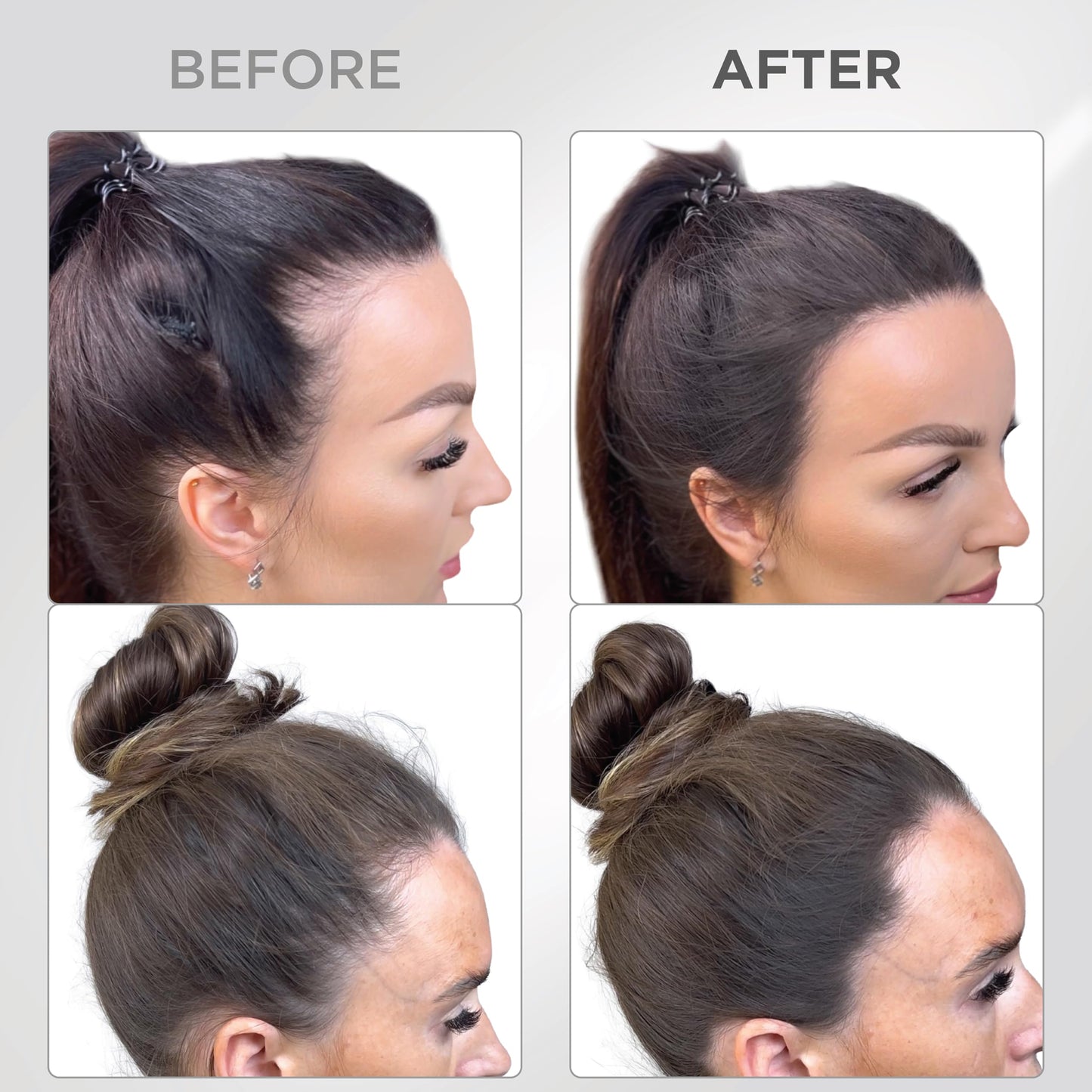 THICK FIBER Root Touch Up & Hairline Powder with Brush 4g – Covers Grey Roots & Thinning Hair – Sweat & Water Resistant – Hair Concealer for Bald Spots & Fill-In (Black) for Women & Men