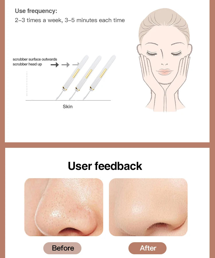 Ultrasonic Skin Scrubber Vibration Face Spatula Blackhead Remover Shovel Clean Cavitation Peeling Facial Lifting skin care