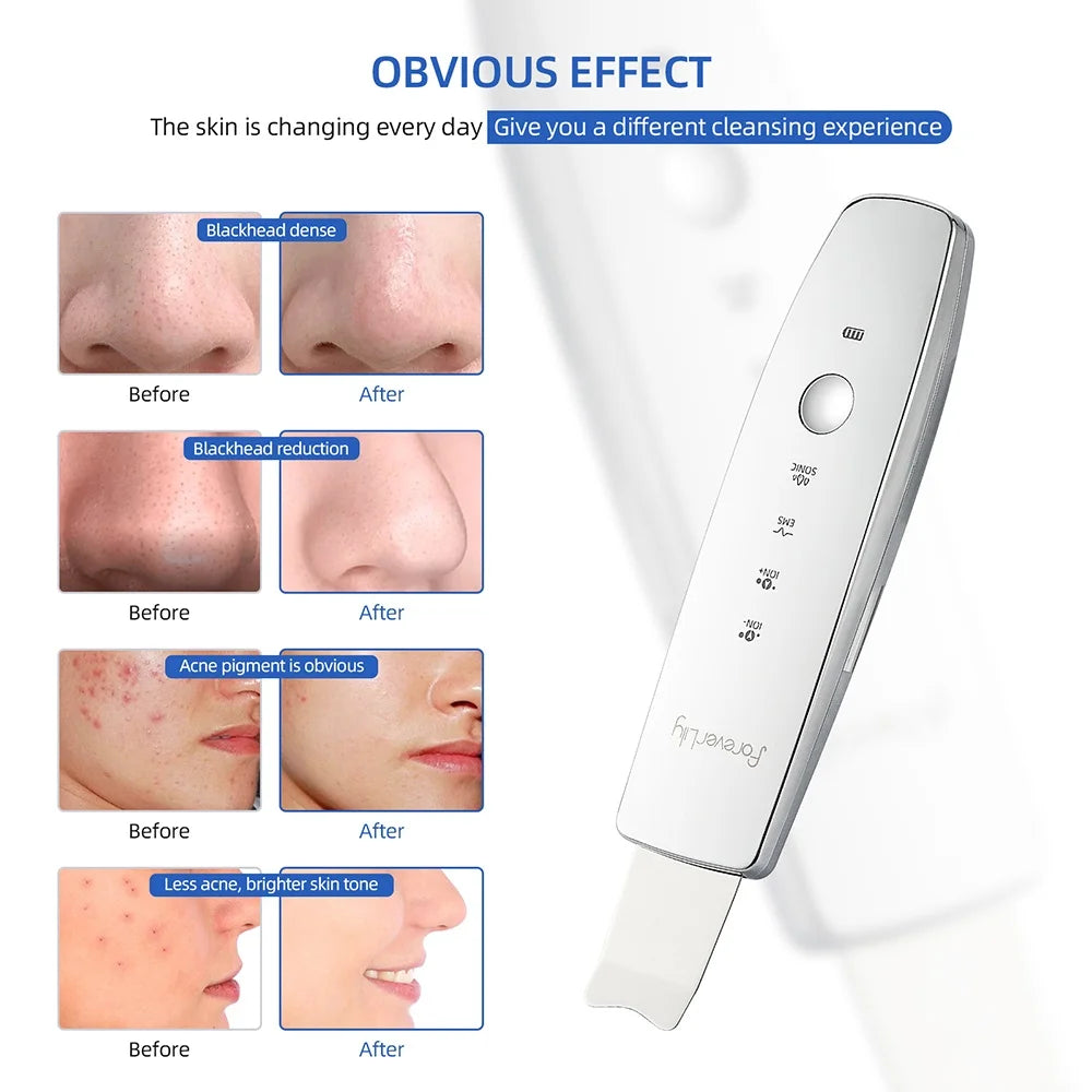 6 in 1 EMS Ultrasonic Skin Scrubber ION LED Photon Skin Lifting Massager Face Spatula Blackhead Remover Facial Deep Cleansing