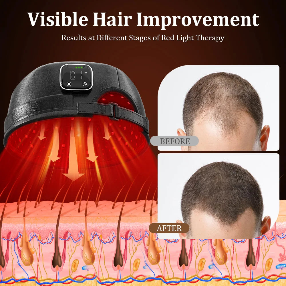 Wireless Hair Growth Laser Cap 120 Diodes 850nm 660nm 4 Levels Anti Hair Loss Stress Relief Infrared Light Relaxation Therapy