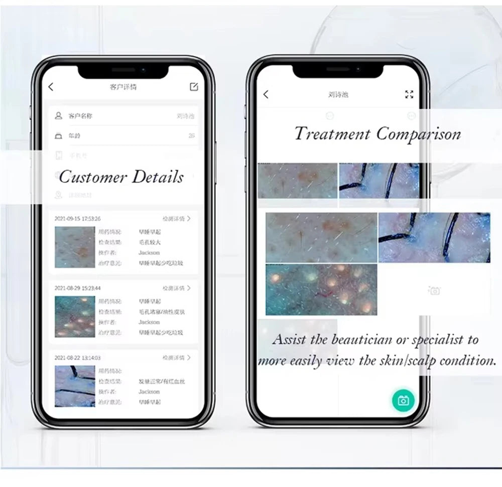 New Professional Wireless HD Intelligent Scalp/Skin/Dermal Detector Hair Follicle Testing Analysis Magnifier UV Skin Analyzer
