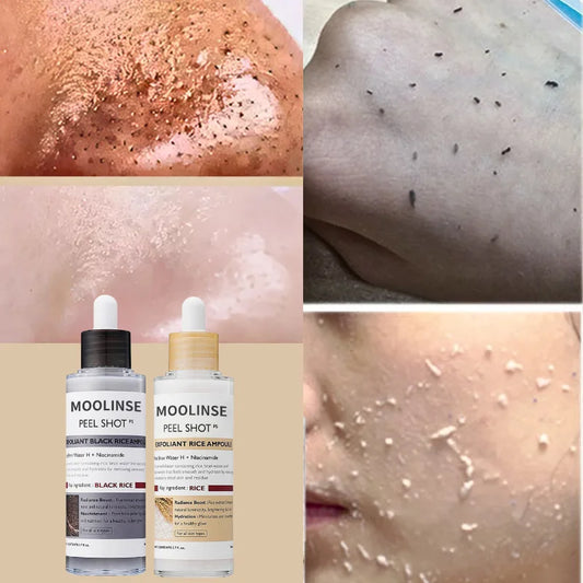 Korean White And Black Rice Exfoliating Serum Facial Moisturizing Soften Blackhead Removal Hydrating Pore Shrinking Skin Care