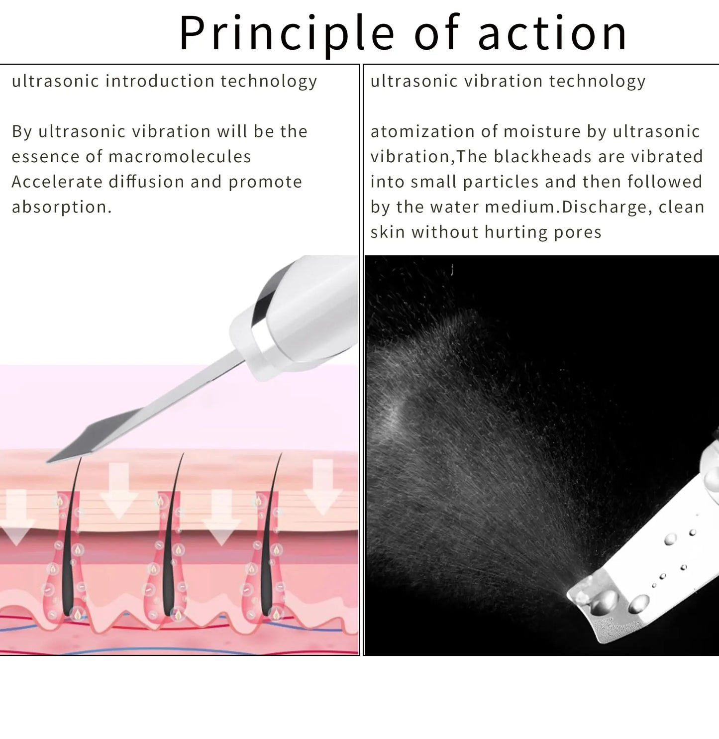RF Skin Tightener, RF EMS Facial Tension Machine, Wrinkle Massager, Facial Cleansing and Exfoliating Care Beauty Tools Ultrasoni