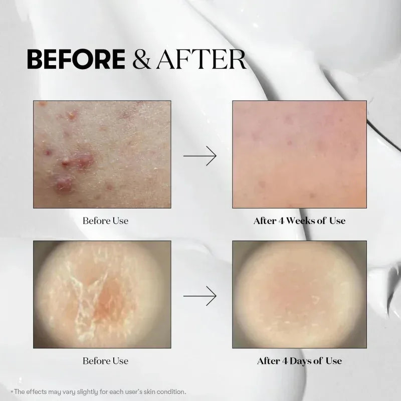 Korean Exosome & Hyaluronic Acid Microneedle Serum - 50ml Skin Booster