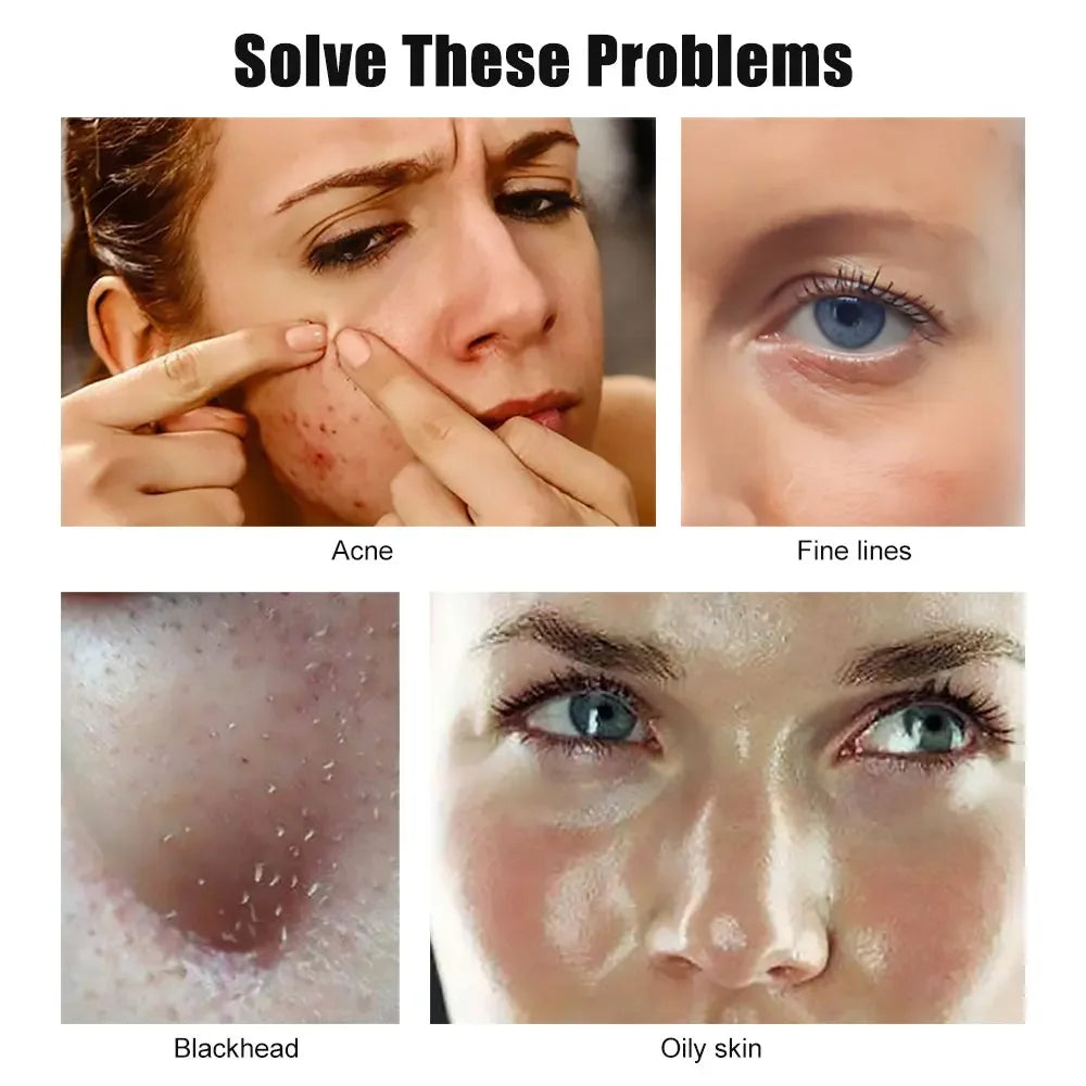 Ultrasonic Skin Scrubber Kit Vibration Face Spatula Blackhead Remover EMS LED Facial Massager Cavitation Peeling Facial Lifting