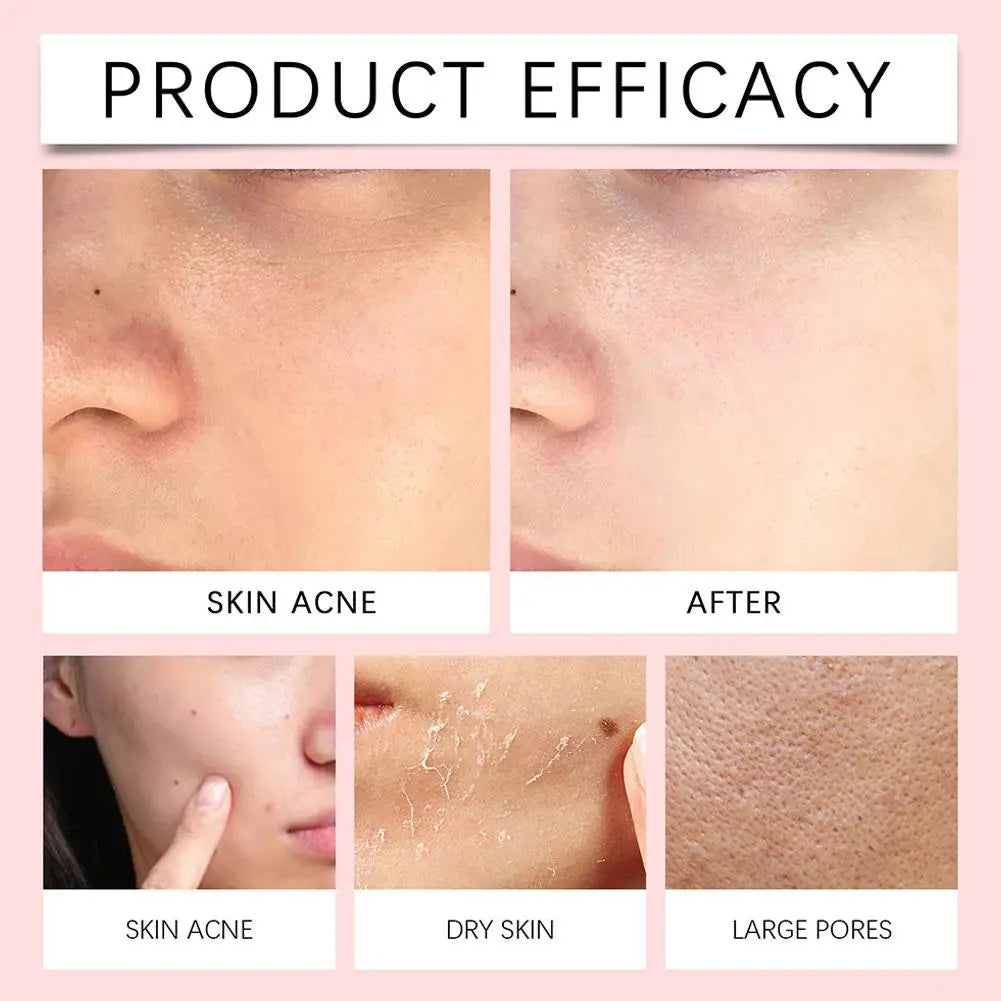 Centella Asiatica Moisturizing Facial Cleanser Deeply Cleanses Facial Skin Repairs Barrier Soothes Sensitive Discomfort Skincare