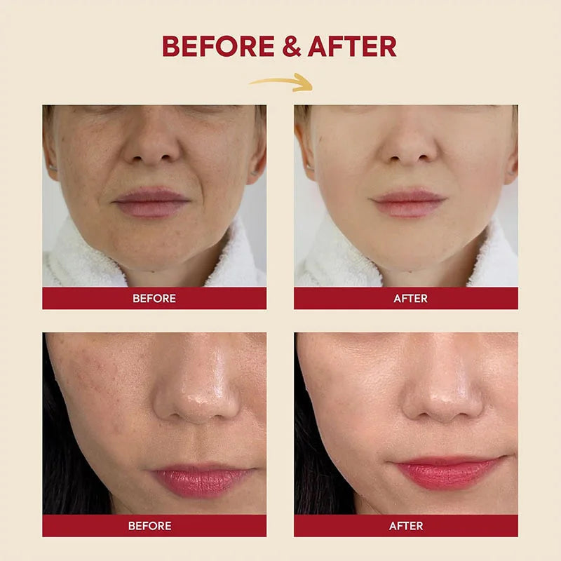 Seoul 1988 Korean Skin Care Set Snail Mucin Eye Contour Care Vitamin C Retinol Dark Circles Removal Seoul 1988 Korean Cosmetics