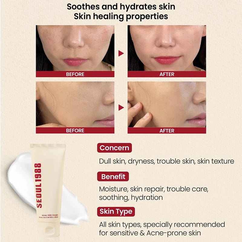 Seoul 1988 Korean Skin Care Set Snail Mucin Eye Contour Care Vitamin C Retinol Dark Circles Removal Seoul 1988 Korean Cosmetics