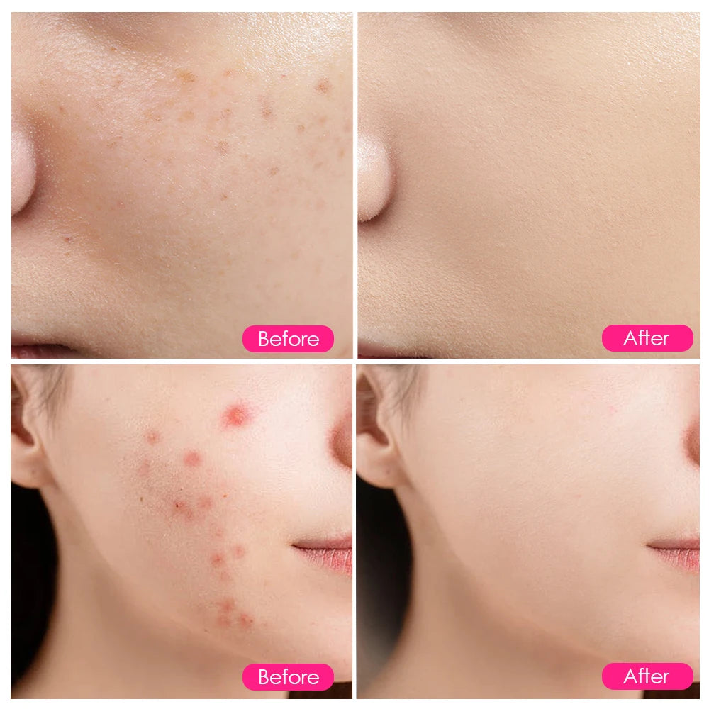 LED Red Light Photon Therapy Face Mask Beauty Instrument Facial SPA Acne Wrinkle Removal Skin Rejuvenation Anti Age Device