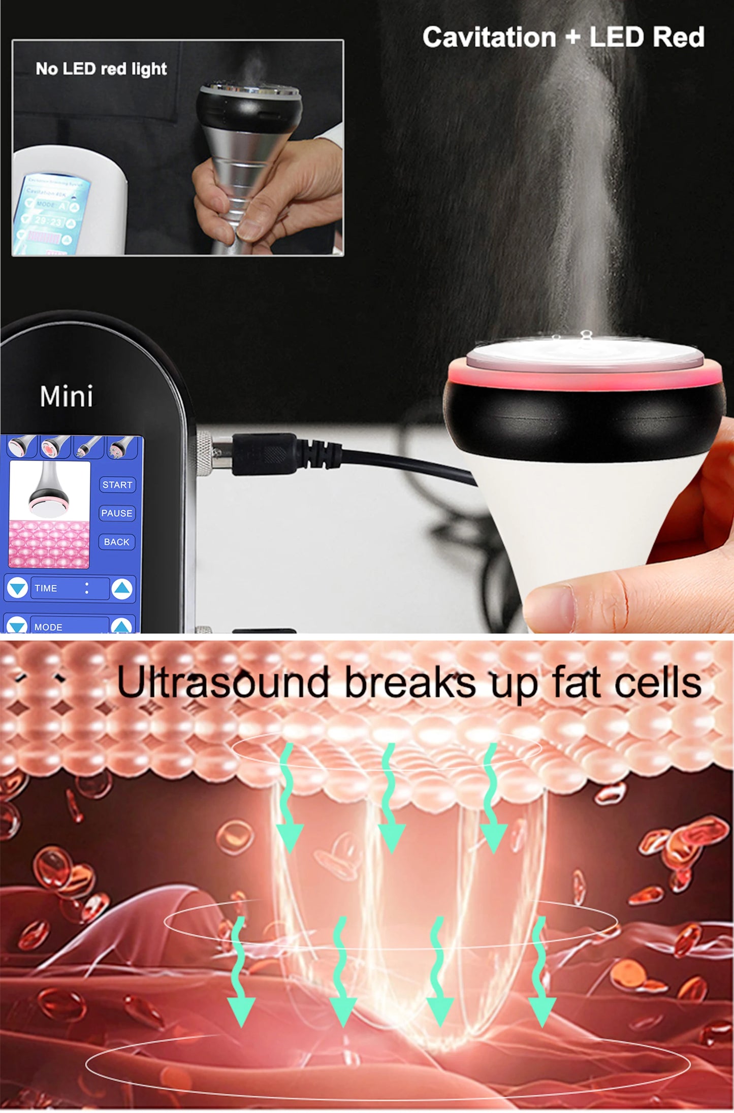 4 in 1 Facial Care 40K Cavitation Lipo Slimming Ultrasonic Liposuction Cavitation Machine Skin Tightening Lifting Device
