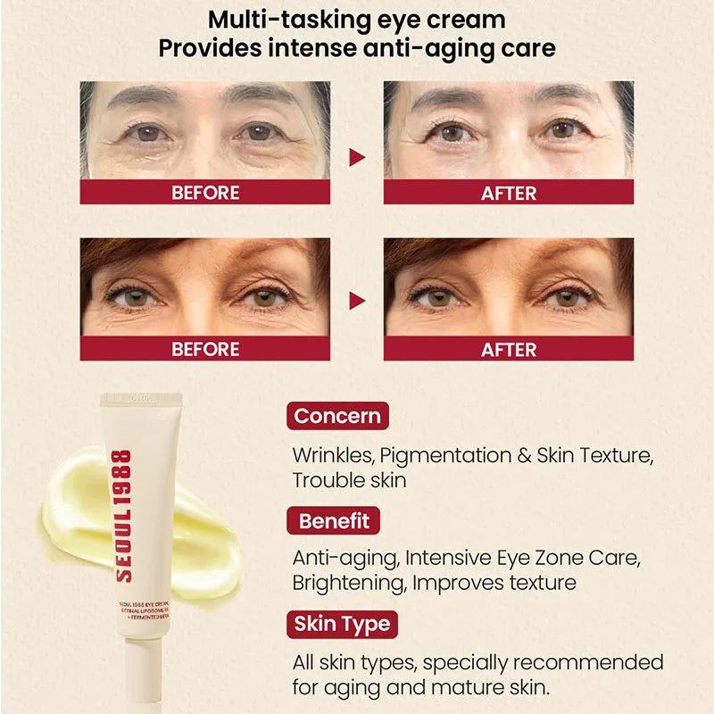 Seoul 1988 Eye Cream, Retinol Serum, Anti-Wrinkle, Anti-Aging, Skin Elasticity, Pigmentation, Niacinamide, Korean Skincare
