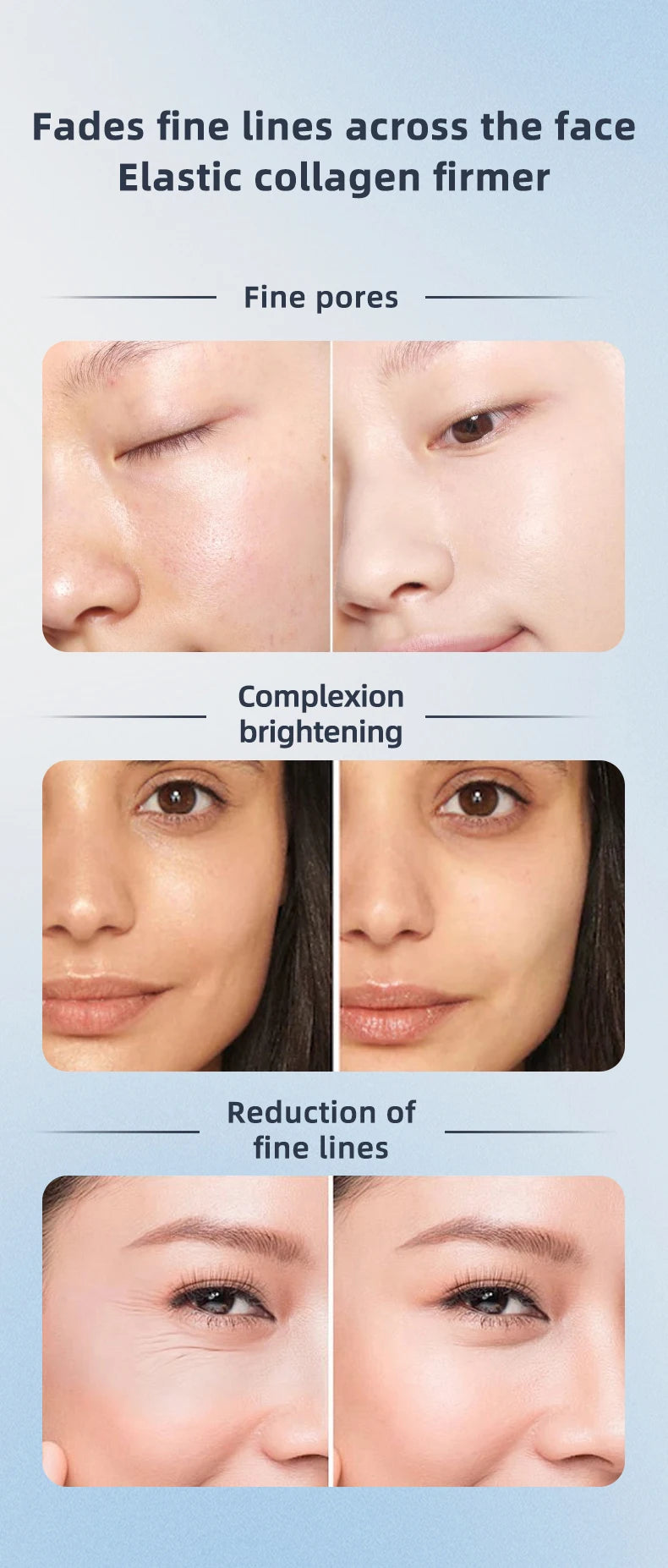 3in1 RF Heating EMS Facial 360° Roller Massager for FIne Lines Lifting Skin Rejuvenation Skin Firm Microcurrent Beauty Machine