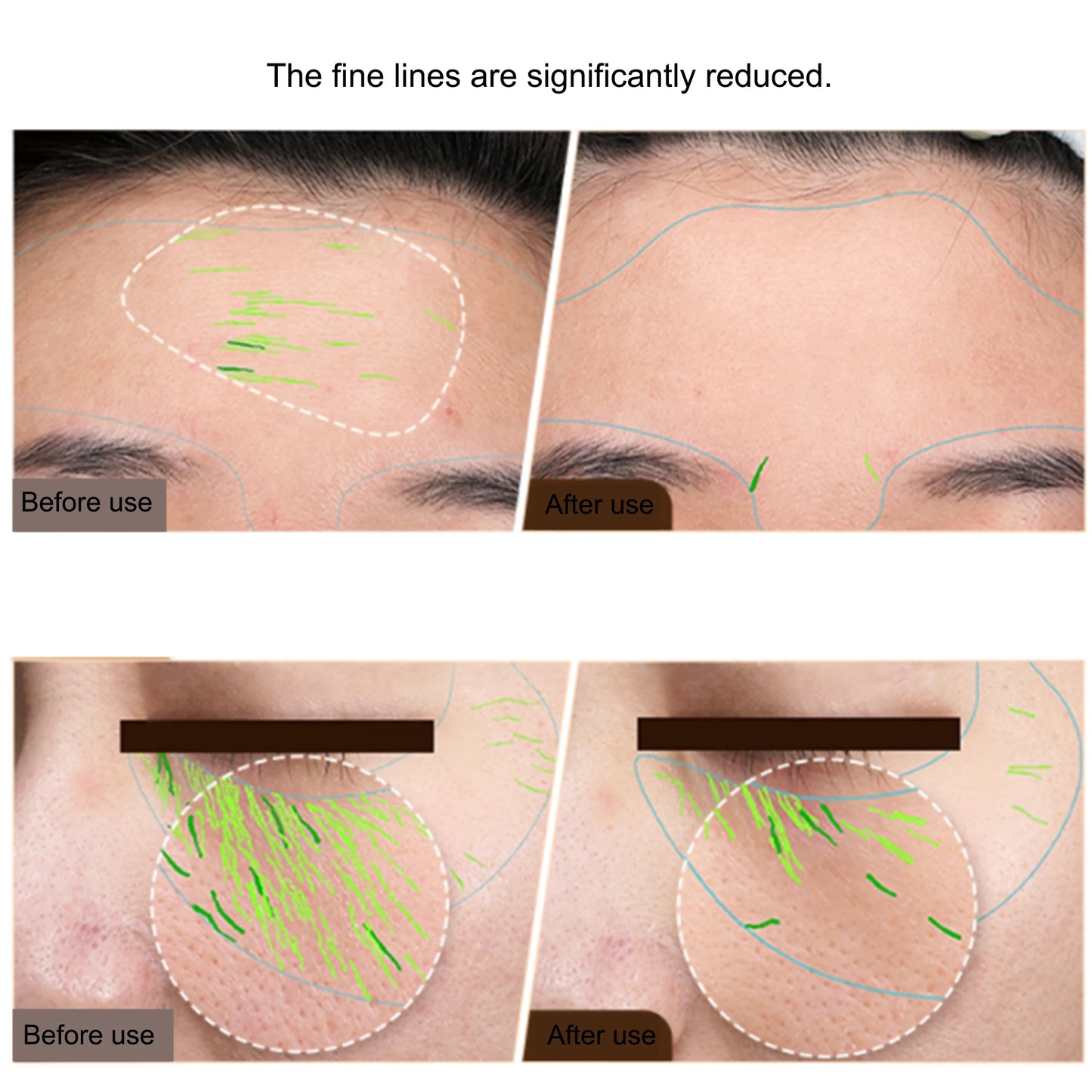 EMS Facial Body Radio Frequency Machine Skin Tightening Face Lifting RF Beauty Device Professional Home RF Skin Care Anti Aging