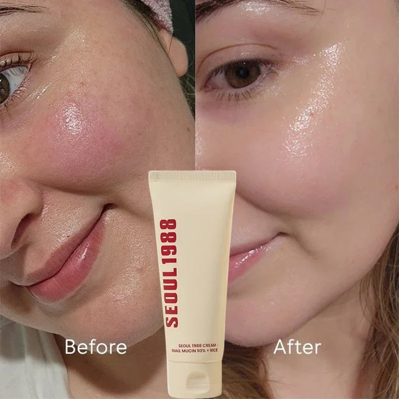 Korean Brand Skin Care Set Seoul 1988 Anti-aging Brightening Eye Cream Sunscreen Anti-wrinkle Essence Rice Cream Essence Water