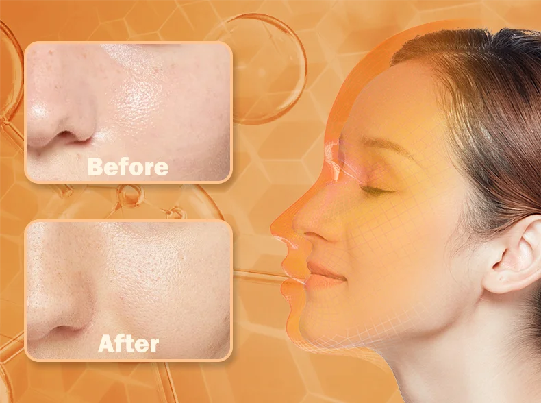 LED Photon Beauty Infrared Mask Instrument USB Electronic Mask Rejuvenation Lightens Fine Lines Brighten Skin Tone Repair Skin