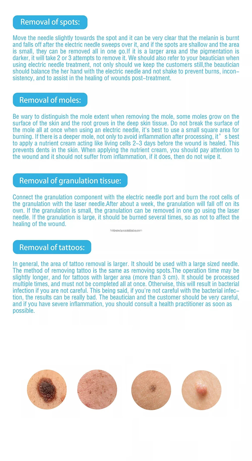 Fibroblast Original Plamax Cold Plasma Wireless Skin Tightly Acne Treatment Dark Age Skin Tag Blemish Removal Beauty Tools