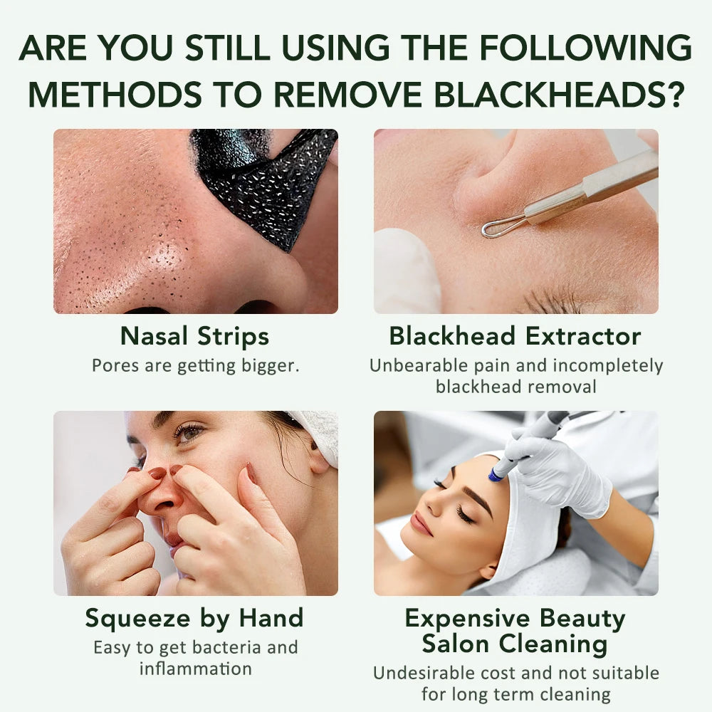 Electric Ultrasonic Skin Scrubber Vibration Face Spatula Peeling Blackhead Remover Facial Lifting Cleansing Ultrasonic Skin Care