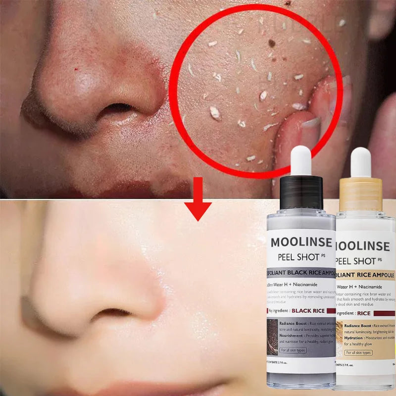 Korean White And Black Rice Exfoliating Serum Facial Moisturizing Soften Blackhead Removal Hydrating Pore Shrinking Skin Care