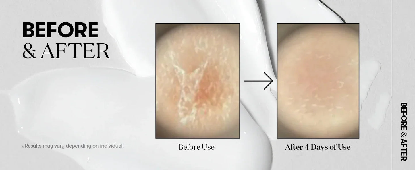 Korean Exosome & Hyaluronic Acid Microneedle Serum - 50ml Skin Booster