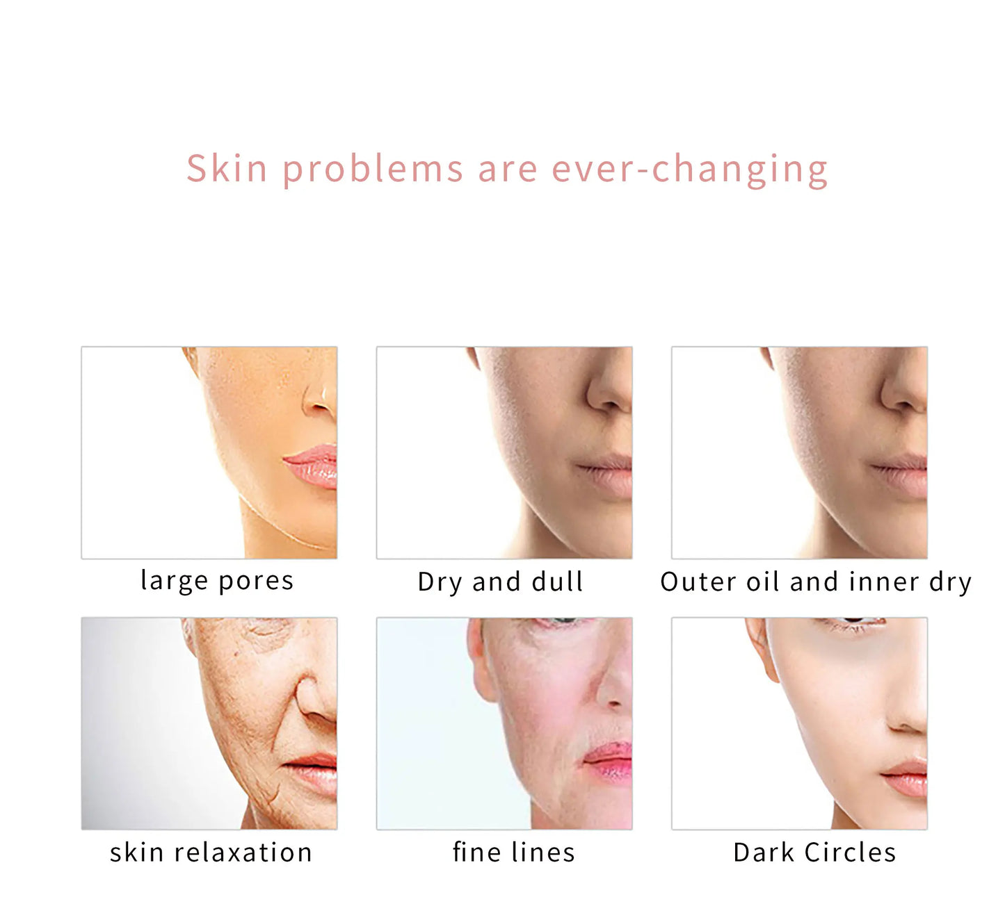 RF Skin Tightener, RF EMS Facial Tension Machine, Wrinkle Massager, Facial Cleansing and Exfoliating Care Beauty Tools Ultrasoni