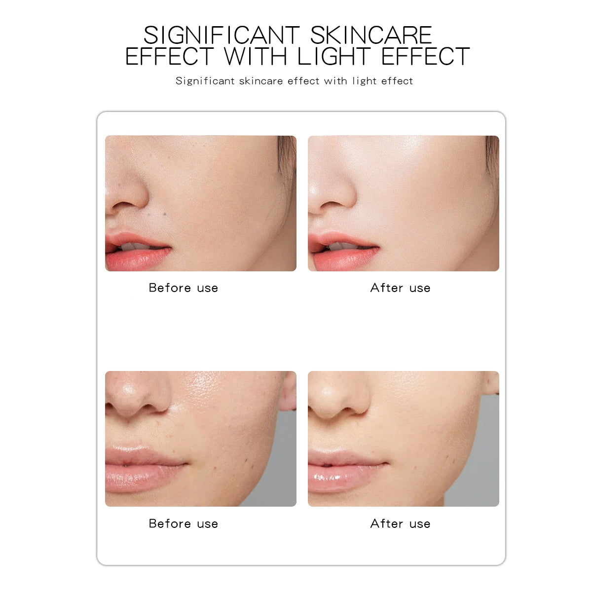 Facial Beauty Massage Device Electric Face Clean Massager Face Skin Care Skin Rejuvenation Beauty Machine Home Devices