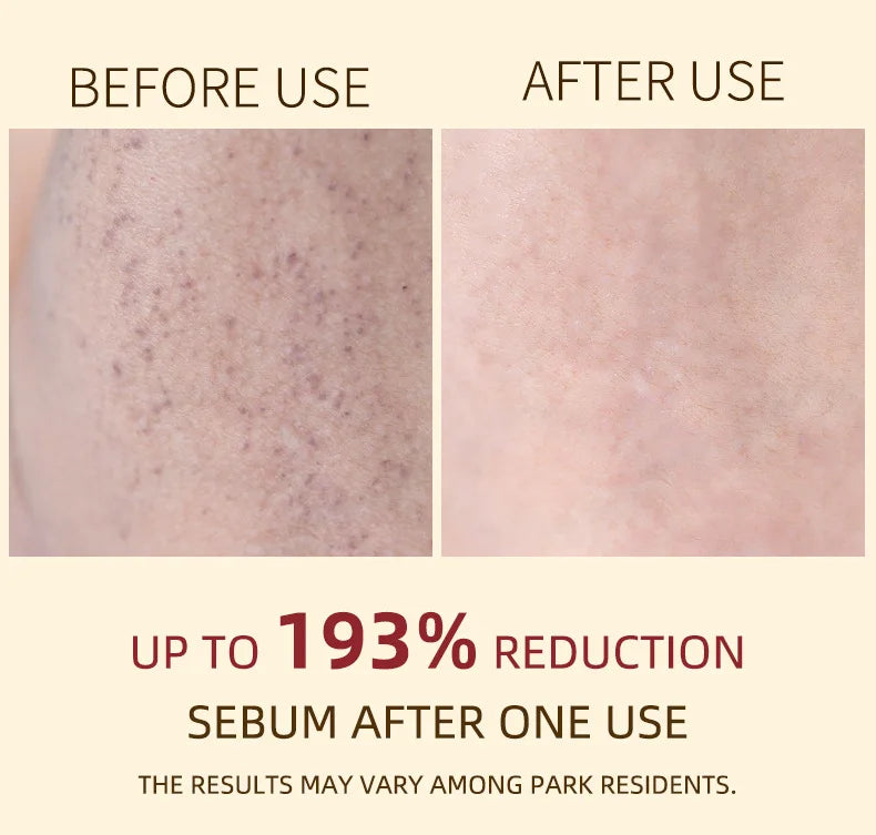 Korean White And Black Rice Exfoliating Serum Facial Moisturizing Soften Blackhead Removal Hydrating Pore Shrinking Skin Care