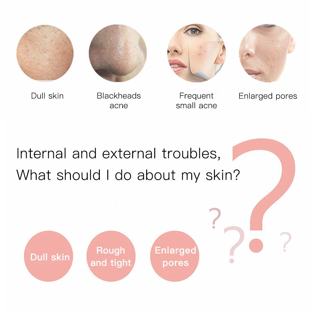 With Box Ultrasonic Skin Scrubber Vibration Face Spatula Peeling Blackhead Remover Facial Lifting Cleansing Ultrasonic Skin Care