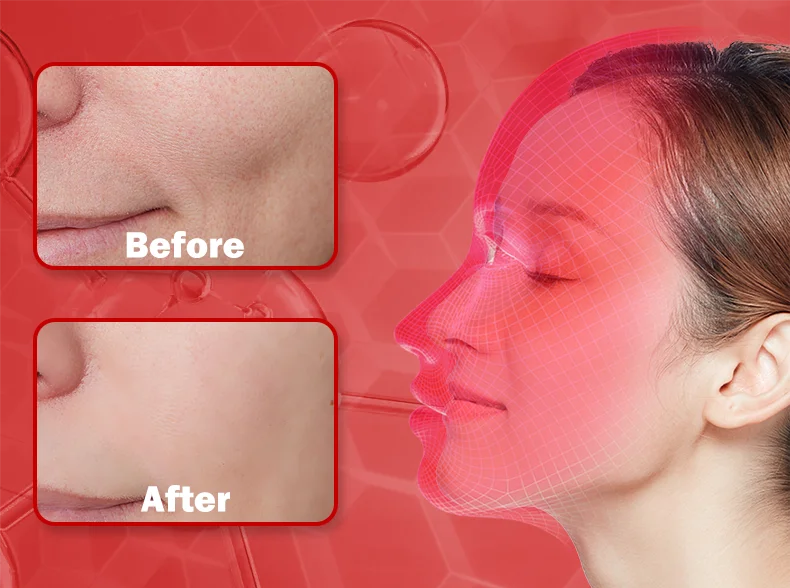 LED Photon Beauty Infrared Mask Instrument USB Electronic Mask Rejuvenation Lightens Fine Lines Brighten Skin Tone Repair Skin