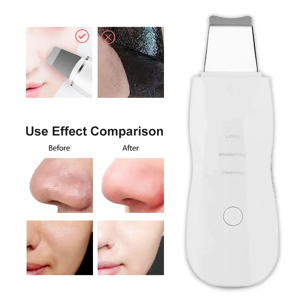 Ultrasonic Skin Scrubber Kit Vibration Face Spatula Blackhead Remover EMS LED Facial Massager Cavitation Peeling Facial Lifting