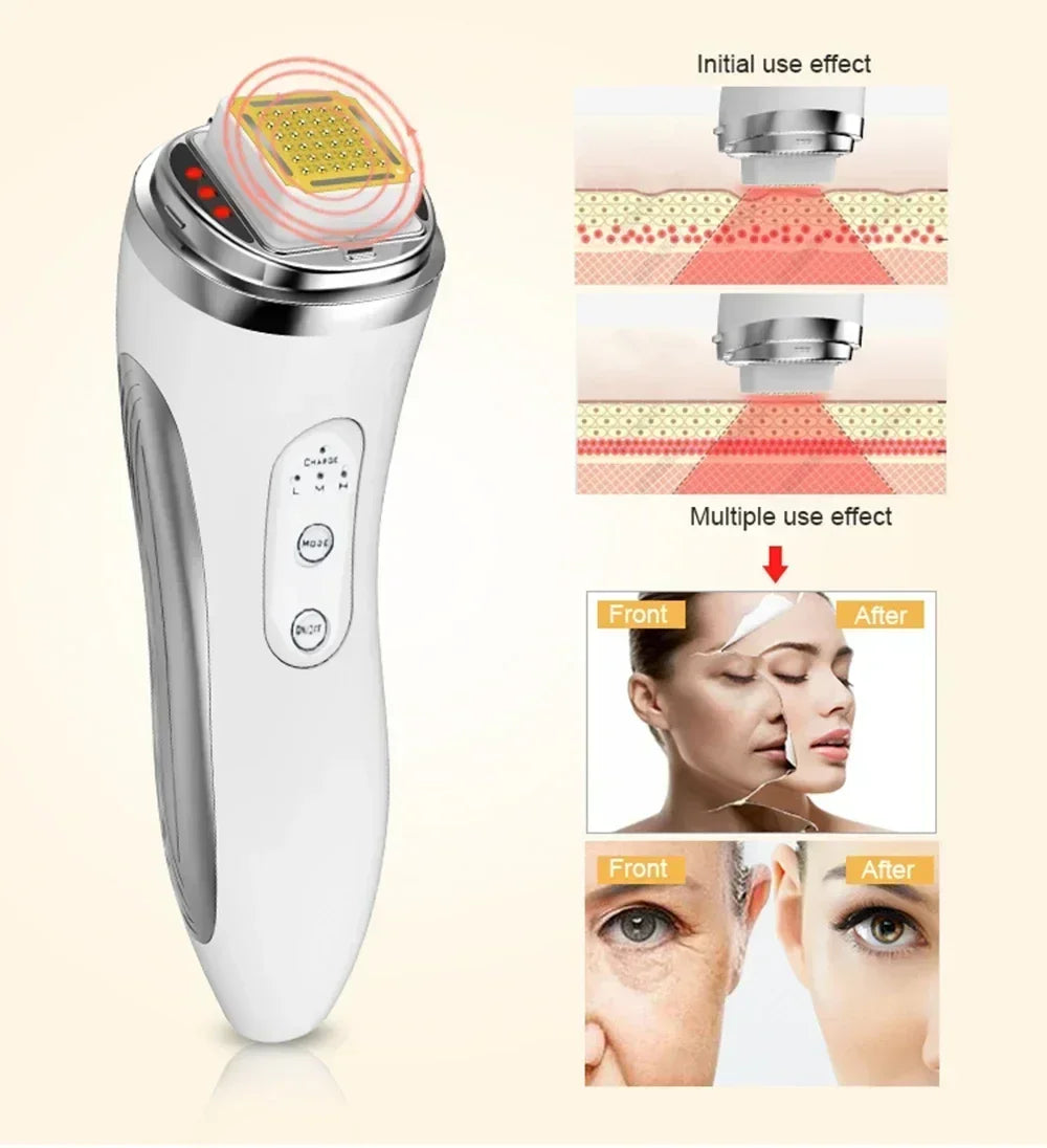 Radio Frequency Facial Lifting Machine Dot Matrix Wrinkle Removal SKin Tightening RF High Frequency Facial Care Massager Device