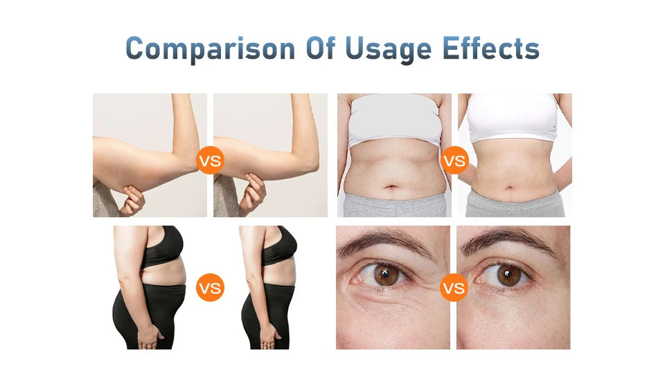 4IN1 Vacuum 40K Body Cavitation Massager Facial Radiofrequency Freckles Removal Fat Burner Cellulite Massager Skin Beauty Device