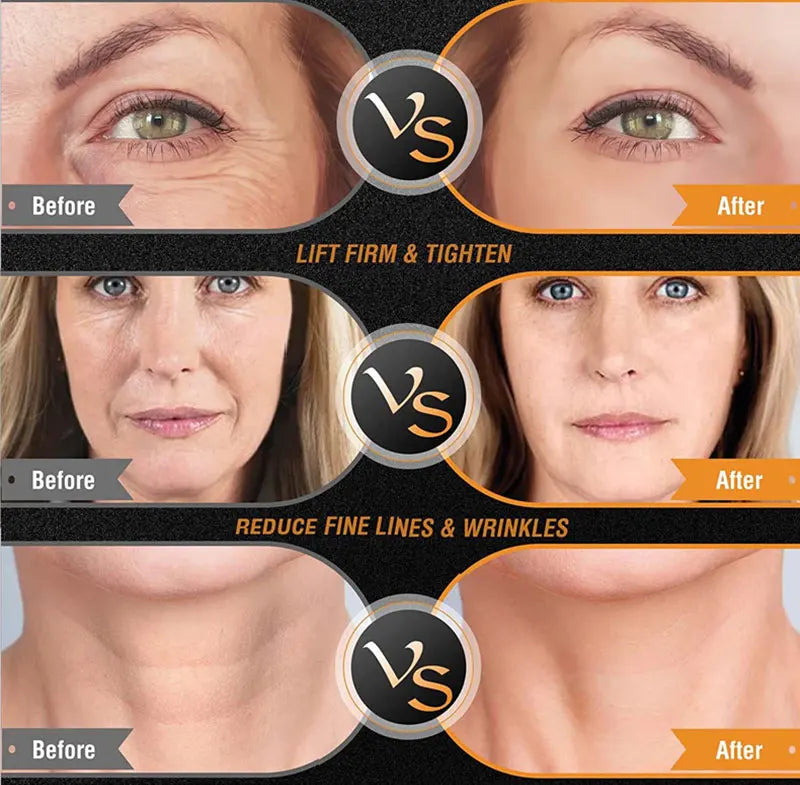 EMS Facial Body Radio Frequency Machine Skin Tightening Face Lifting RF Beauty Device Professional Home RF Skin Care Anti Aging