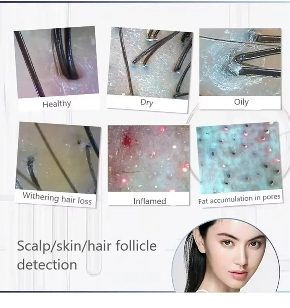 New Professional Wireless HD Intelligent Scalp/Skin/Dermal Detector Hair Follicle Testing Analysis Magnifier UV Skin Analyzer