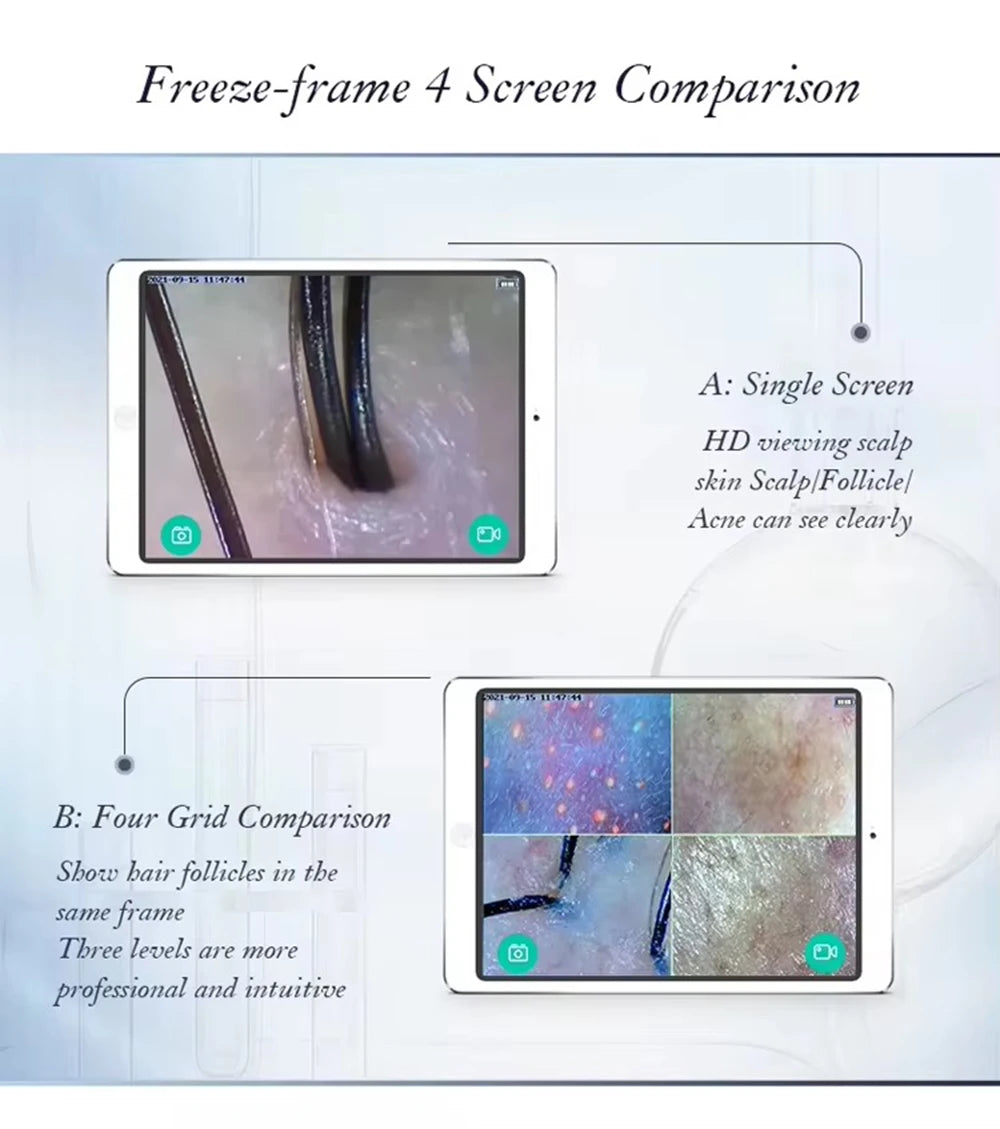 New Professional Wireless HD Intelligent Scalp/Skin/Dermal Detector Hair Follicle Testing Analysis Magnifier UV Skin Analyzer