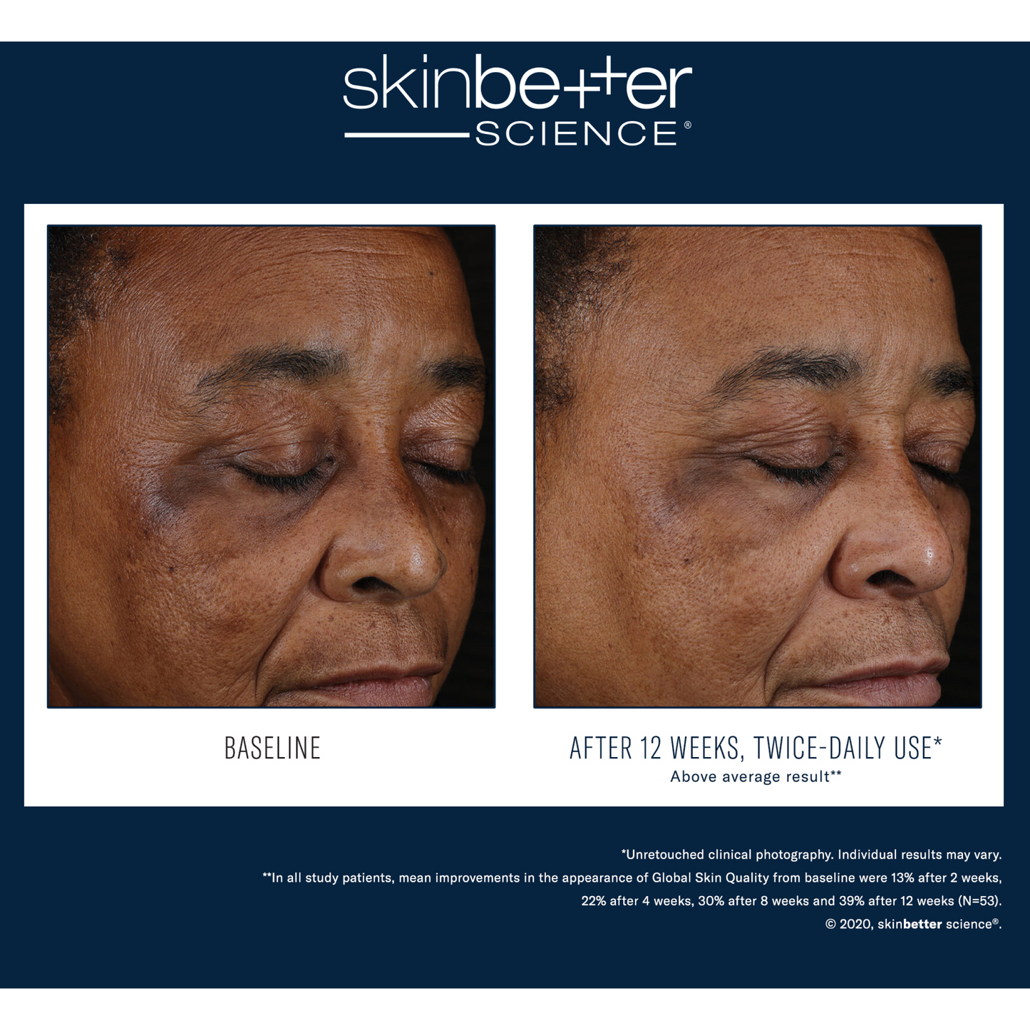 SkinBetter Mystro Active Balance Serum