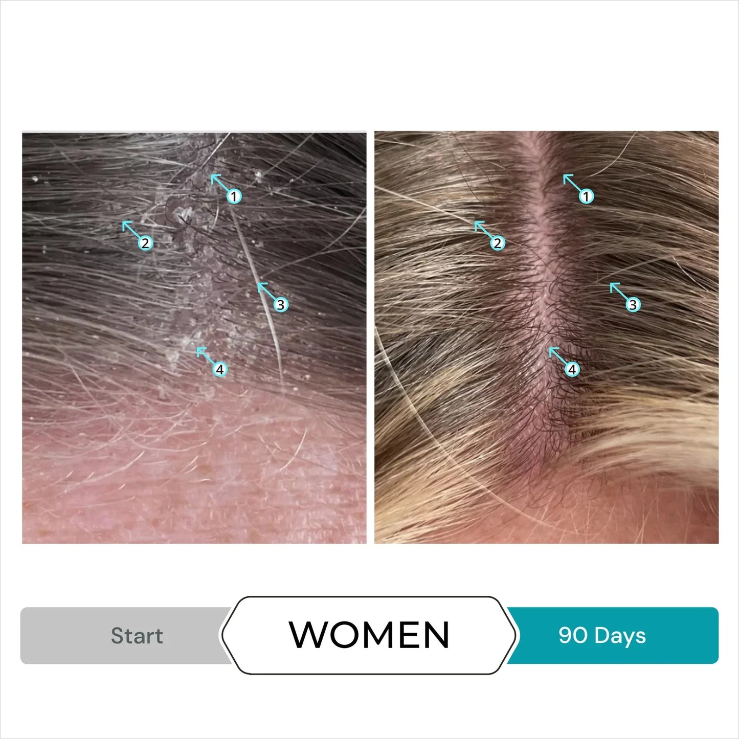 Dandrene Anti-Dandruff Conditioner