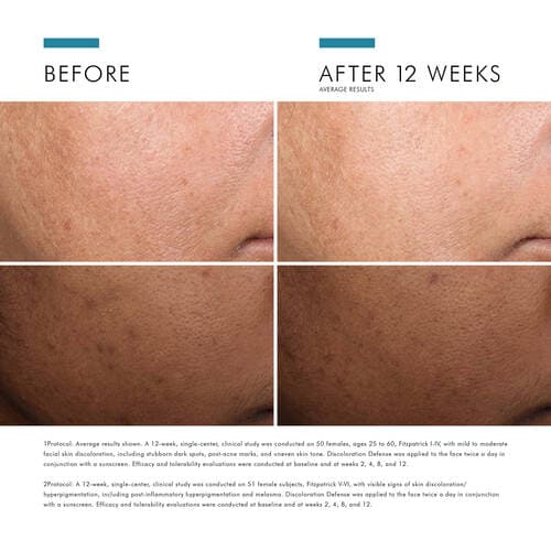 SkinCeuticals Discoloration Defense solution