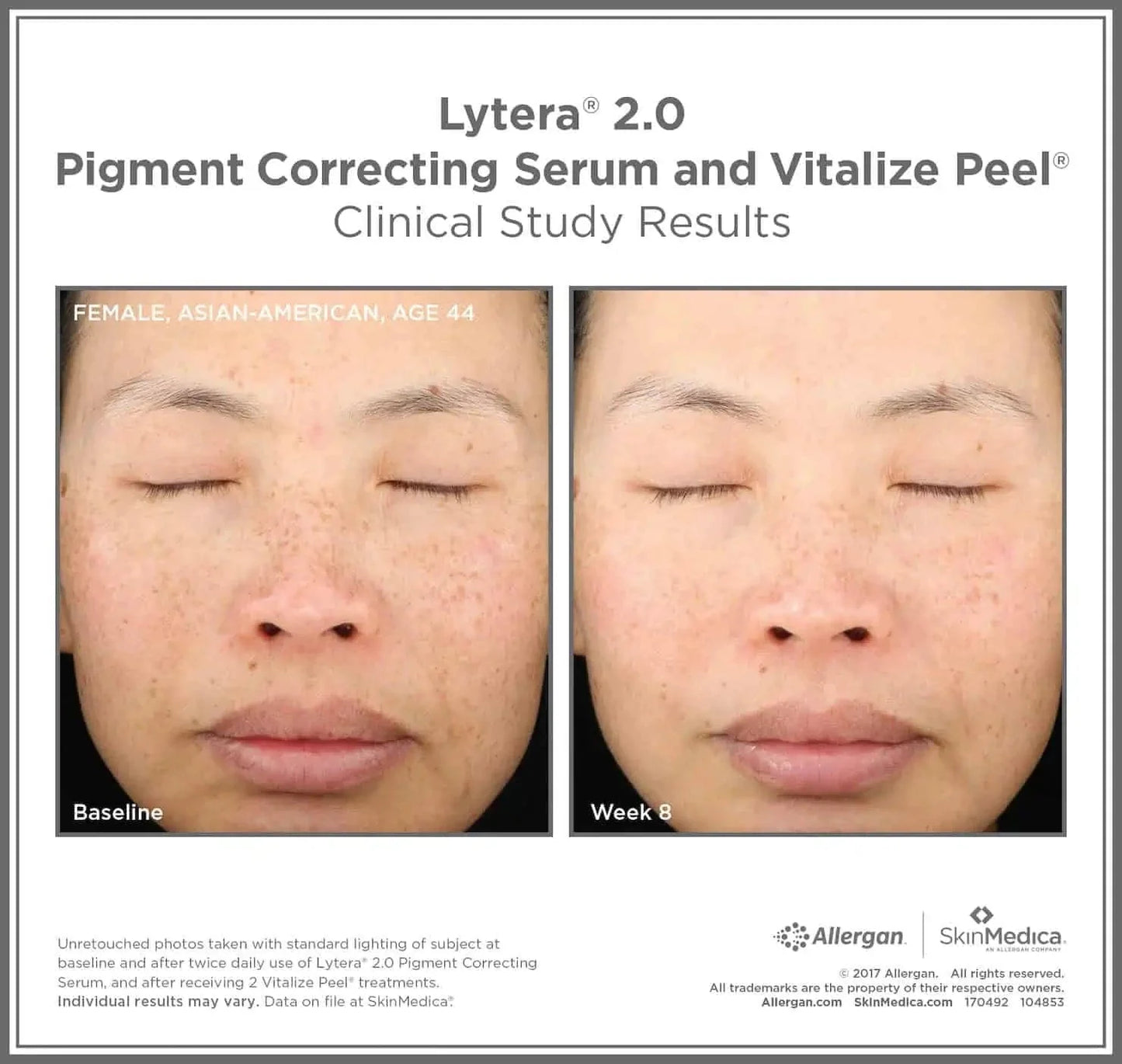 SkinMedica Lytera 2.0 Brightening Serum