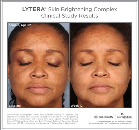SkinMedica Lytera 2.0 Brightening Serum