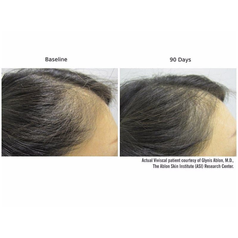 Viviscal Professional Hair Growth