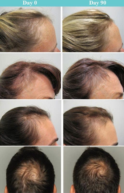 Viviscal Professional Hair Growth