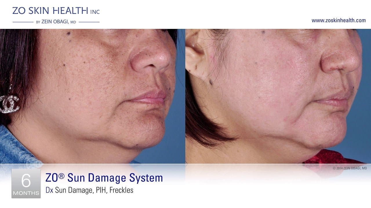 ZO Firming Serum