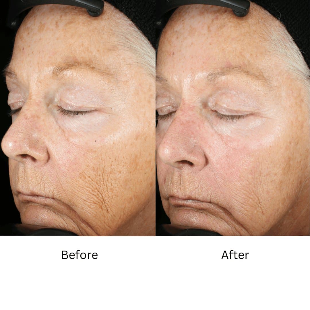 ZO Wrinkle and Texture Repair